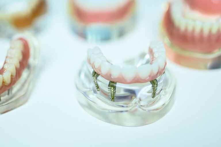 How Freehand and Guided Dental Implant Surgery Compare LaGrange Oral