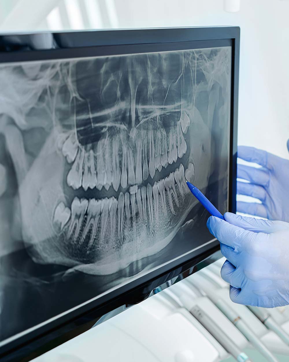 A team member examines a dental x-ray at LaGrange Oral Surgery & Implant Center.