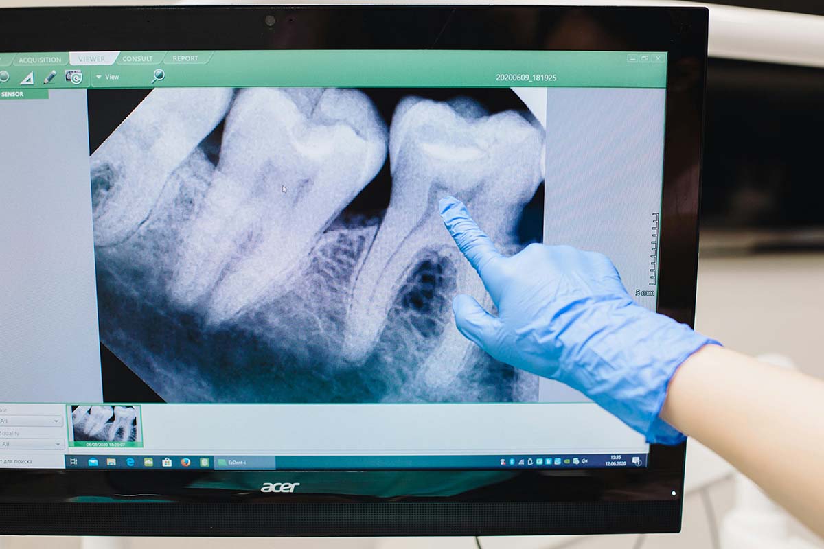 A dental technician works on a computer, analyzing an x-ray.